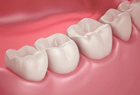 gum disease, healthy teeth
